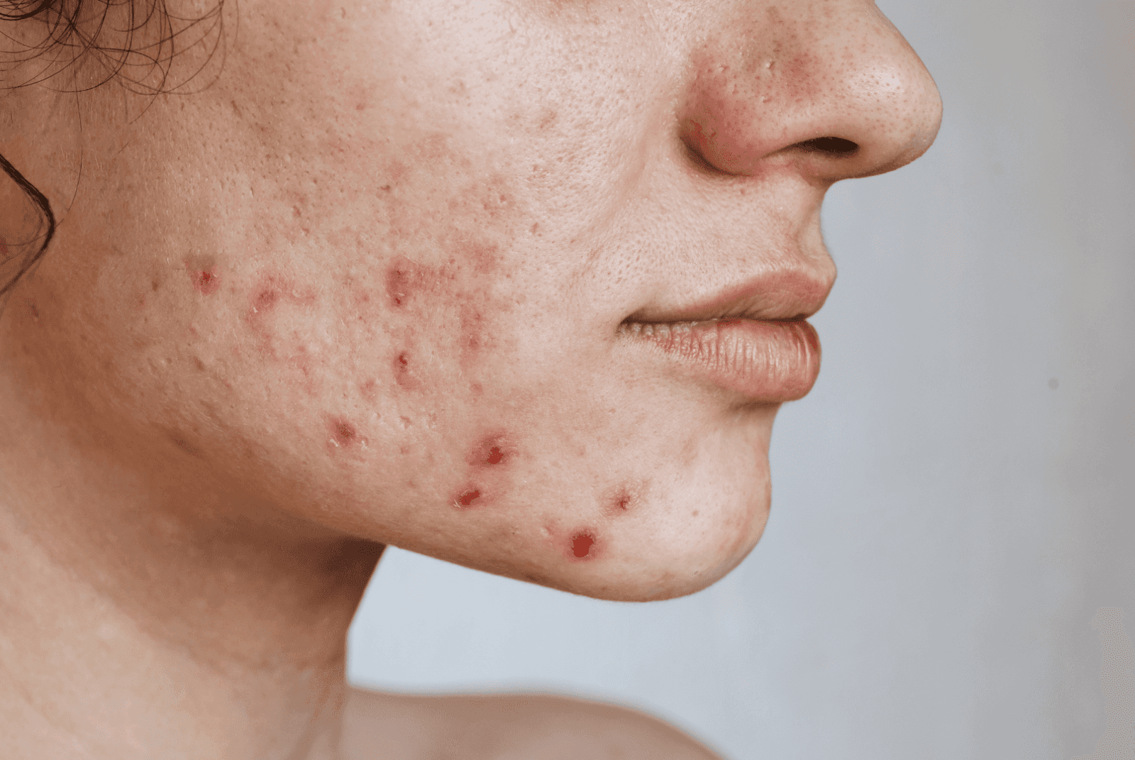 Зображення для статті: Шлях до чистої шкіри: у цьому випуску про головні помилки догляду за обличчям