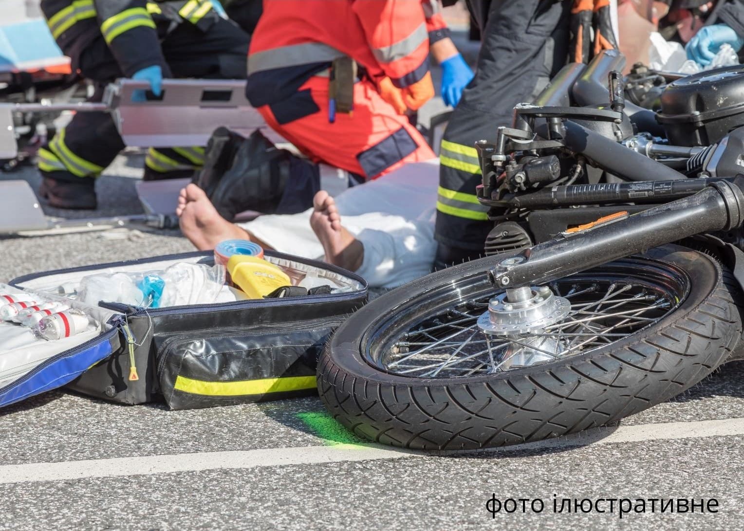 Зображення для статті: Дві аварії на Закарпатті: травми отримали хлопці 14, 16 й 17 років