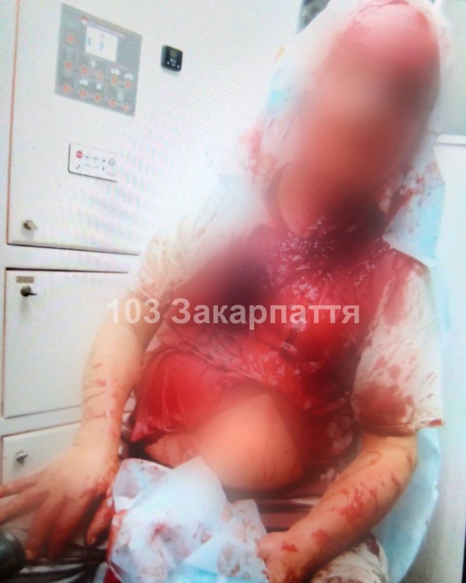 Зображення для статті: В Ужгороді власний собака покусав 60-річного чоловіка: потерпілого госпіталізували
