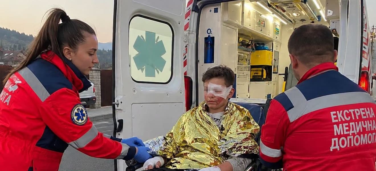 Зображення для статті: На Рахівщині 12-річний хлопець отримав опіки через піротехнічний виріб