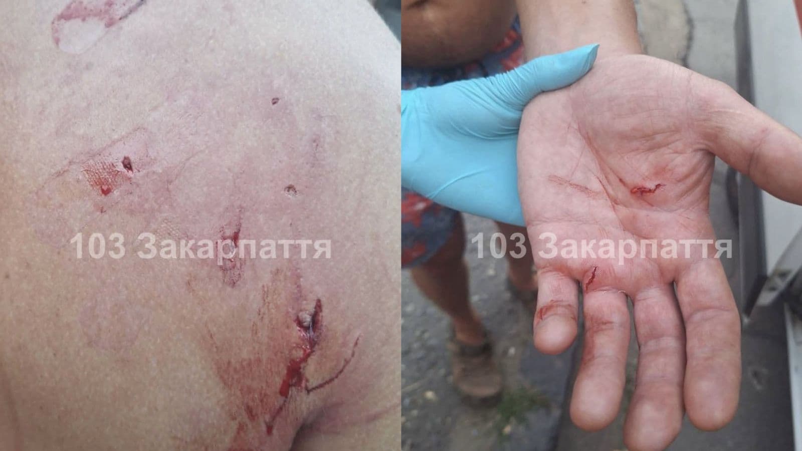 Зображення для статті: В Ужгороді собака покусав двох людей: постраждалих госпіталізували