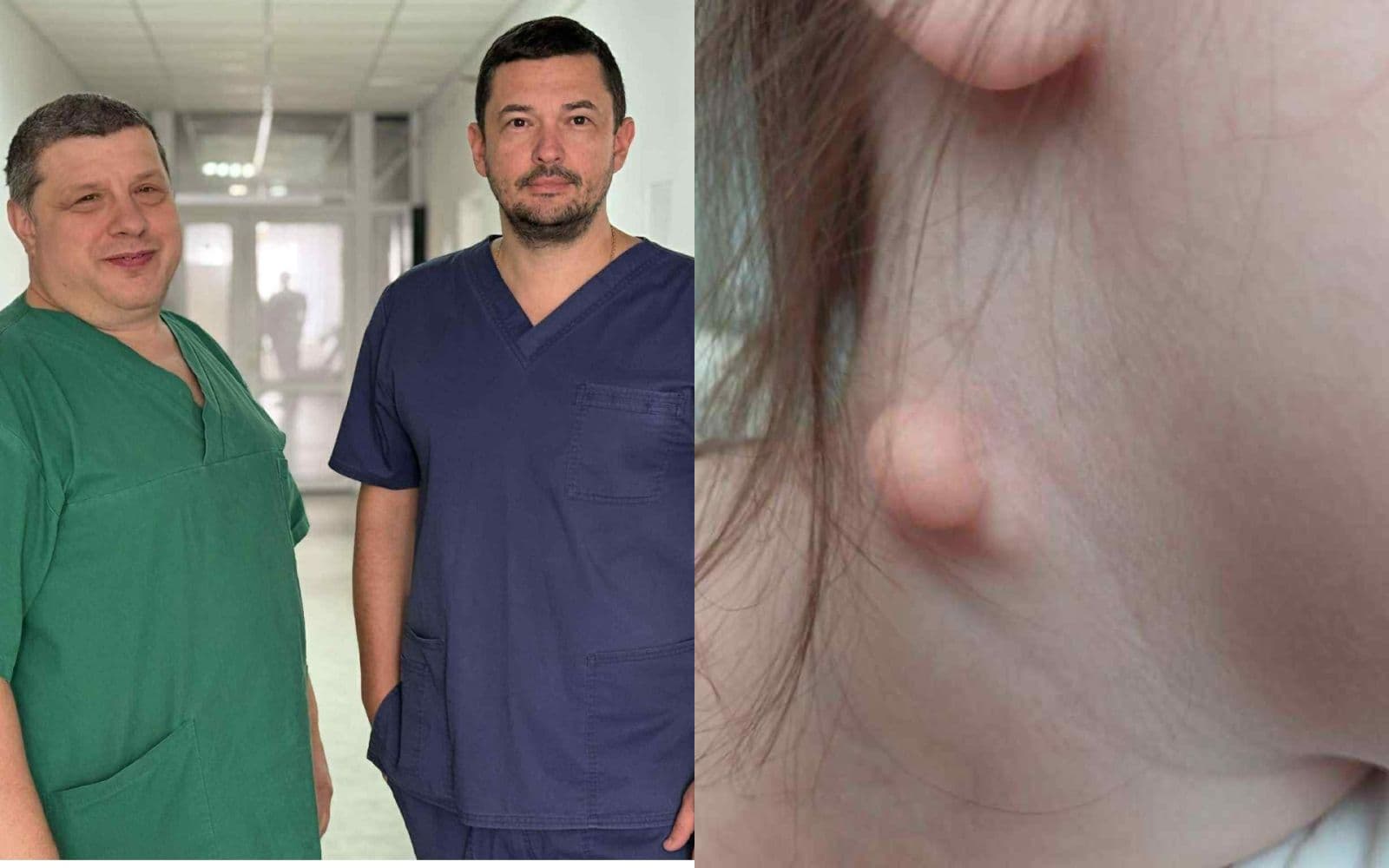 Зображення для статті: Мукачівські хірурги успішно видалили рідкісну кісту шиї у п’ятирічної дитини