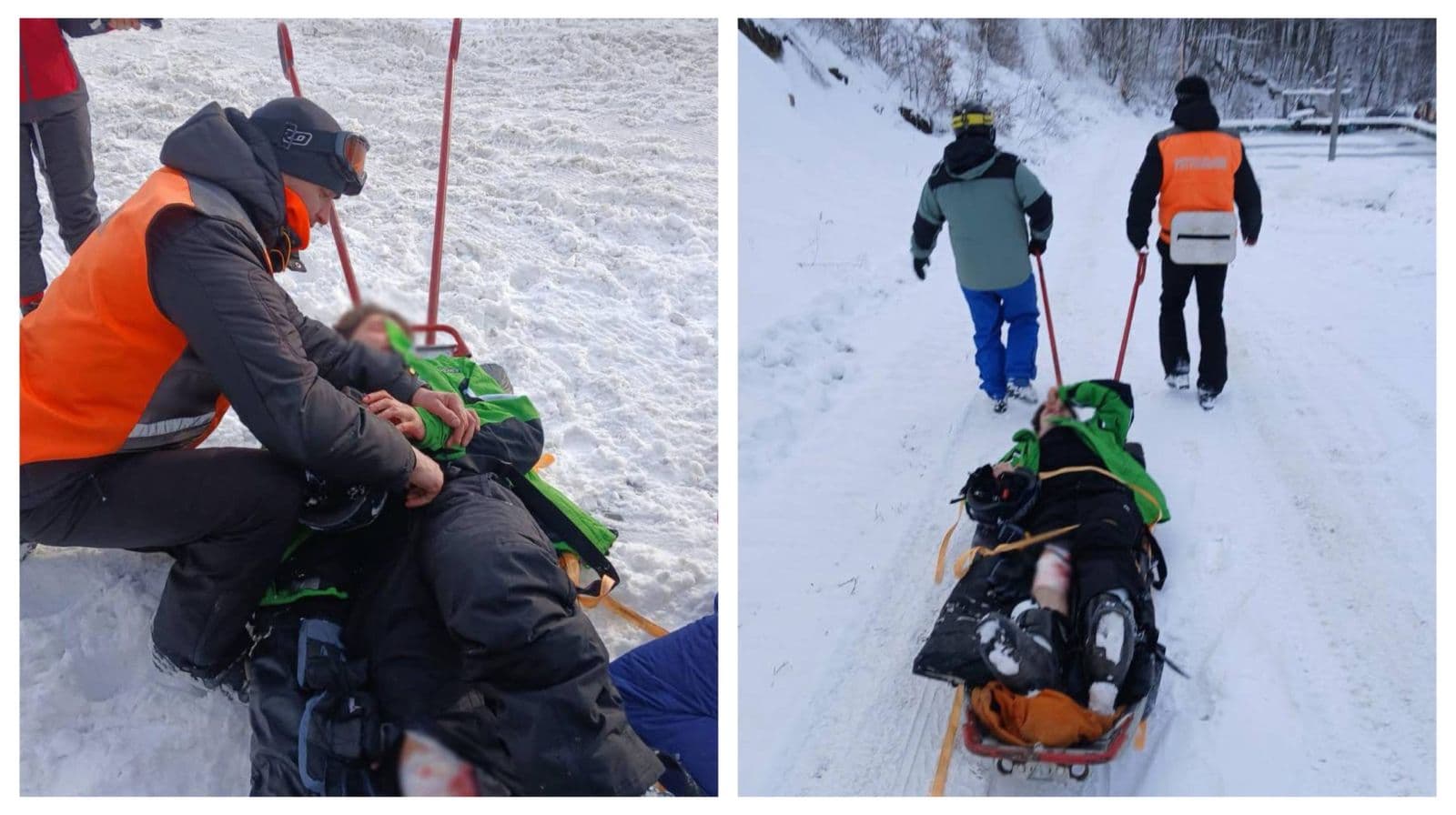 Зображення для статті: На Закарпатті під час катання на лижах травмувався 19-річний чоловік