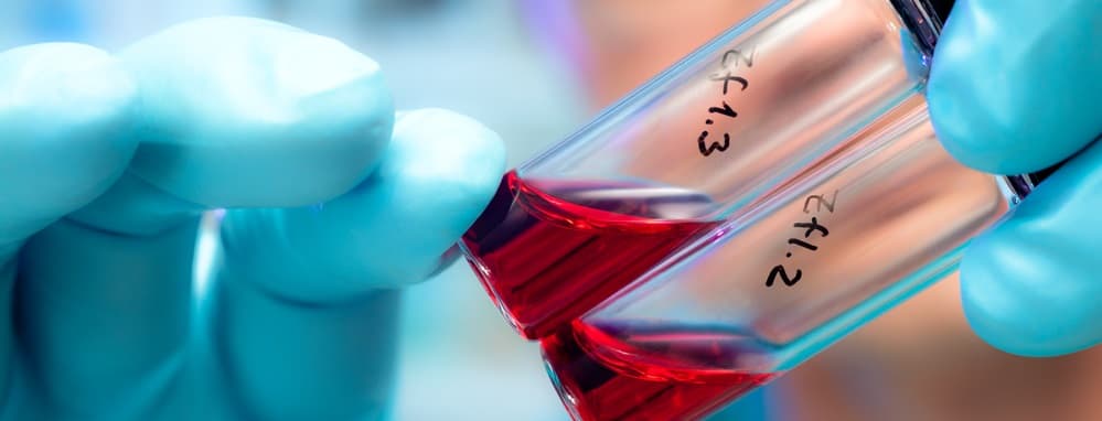 Зображення для статті: Туберкульоз відступає, ВІЛ поширюється: на Закарпатті обговорили стан захворюваності