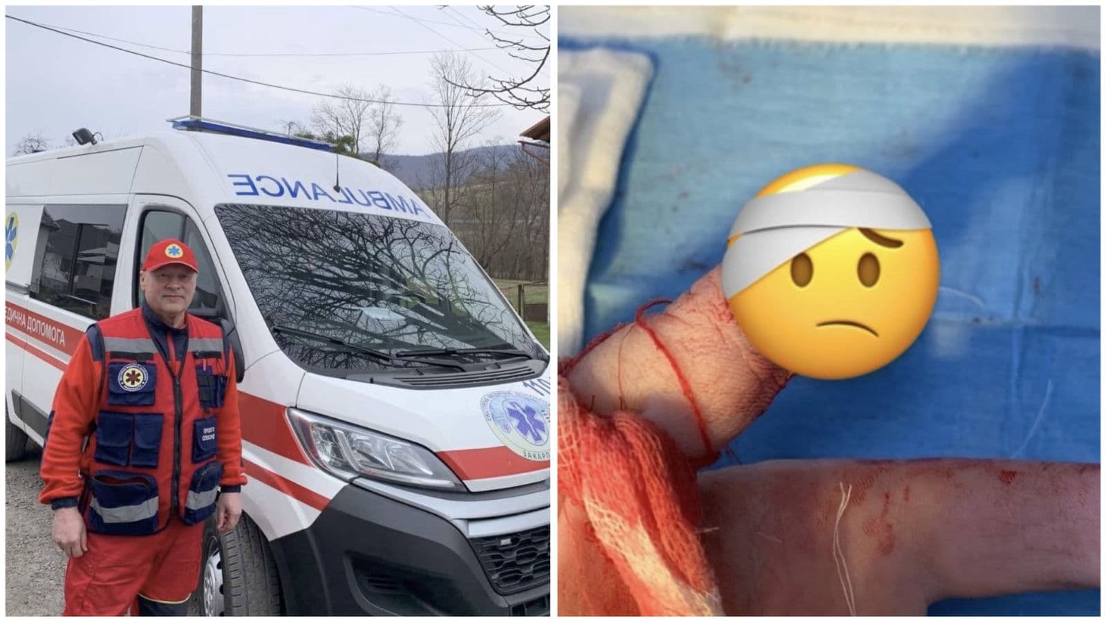 Зображення для статті: Нещасний випадок на кухні: 16-річна дівчина отримала часткову ампутацію пальця